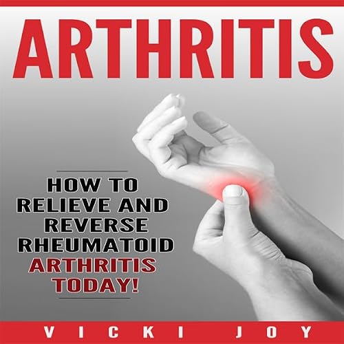Cover of Arthritis