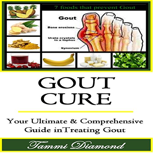 Cover of Gout Cure
