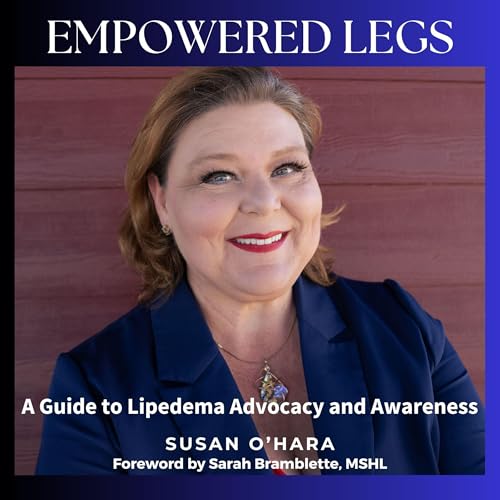 Cover of Empowered Legs: A Guide to Lipedema Advocacy and Awareness