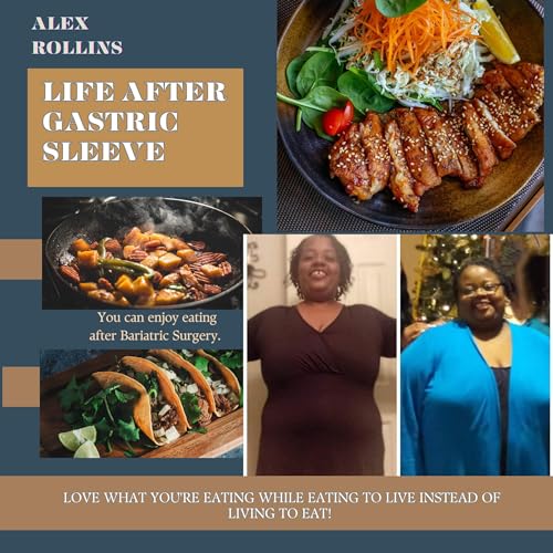 Cover of Life After Gastric Sleeve