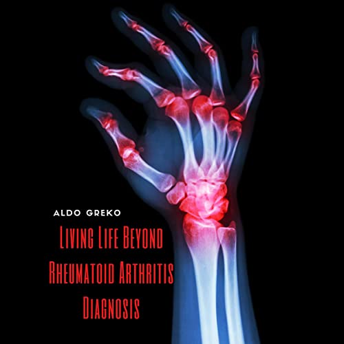 Cover of Living Life Beyond Rheumatoid Arthritis Diagnosis