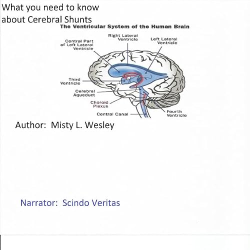 Cover of What You Should Know About Cerebral Shunts