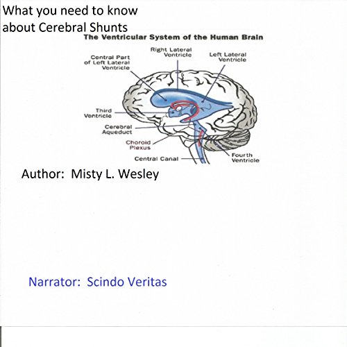 Cover of What You Should Know About Cerebral Shunts