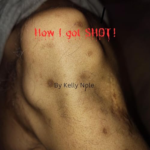 Cover of How I Got Shot!