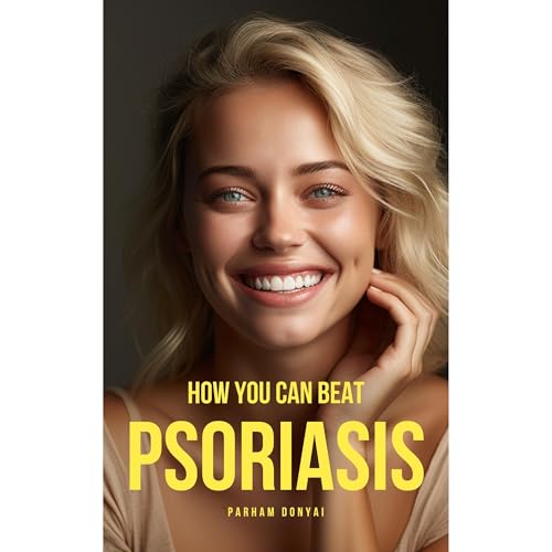 Cover of How You Can Beat Psoriasis