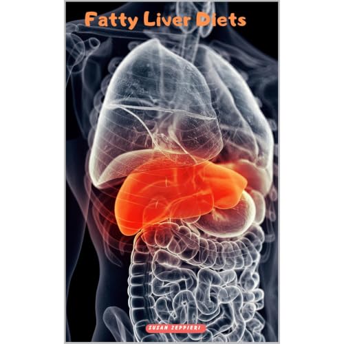 Cover of Fatty Liver Diets