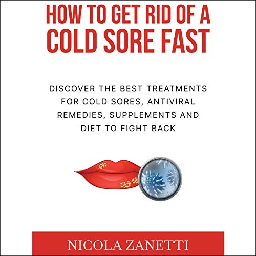 Cover of How to Get Rid of a Cold Sore Fast
