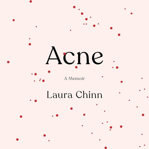 Cover of Acne