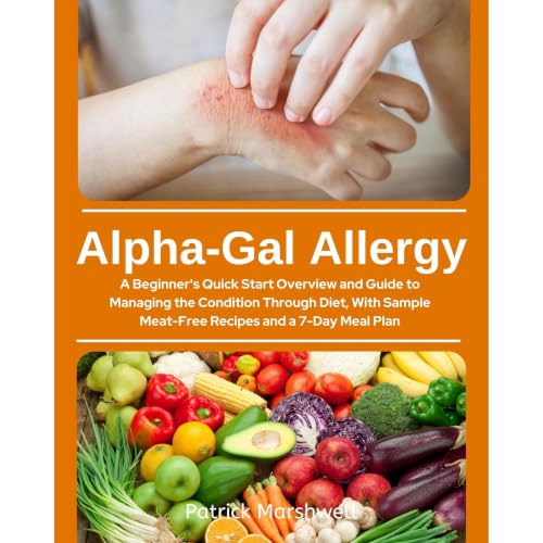 Cover of Alpha-Gal Allergy: A Beginner's Quick Start Overview and Guide to Managing the Condition Through Diet, with Sample Meat-Free Recipes and a 7-Day Meal Plan