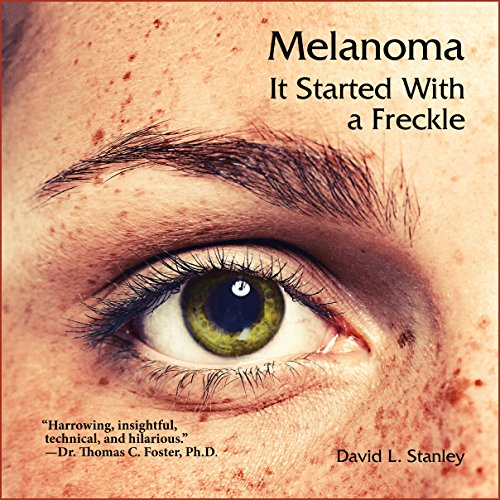 Cover of Melanoma