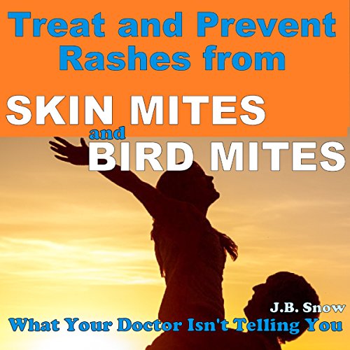 Cover of Treat and Prevent Rashes from Skin Mites and Bird Mites