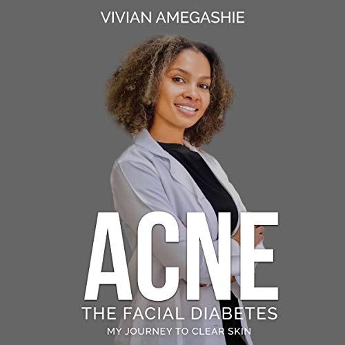Cover of Acne: The Facial Diabetes