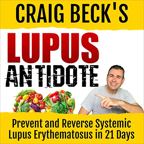 Cover of Lupus Antidote