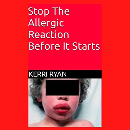 Cover of Stop the Allergic Reaction Before It Starts