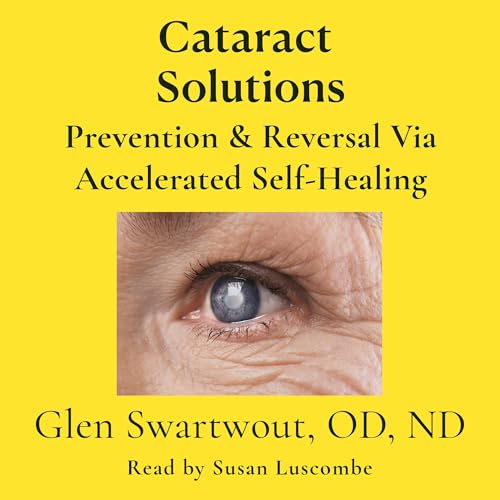 Cover of Cataract Solutions: Prevention & Reversal via Accelerated Self-Healing