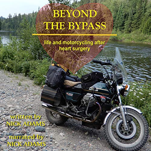 Cover of Beyond the Bypass