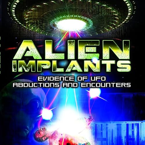 Cover of Alien Implants