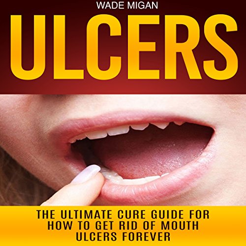Cover of Ulcers