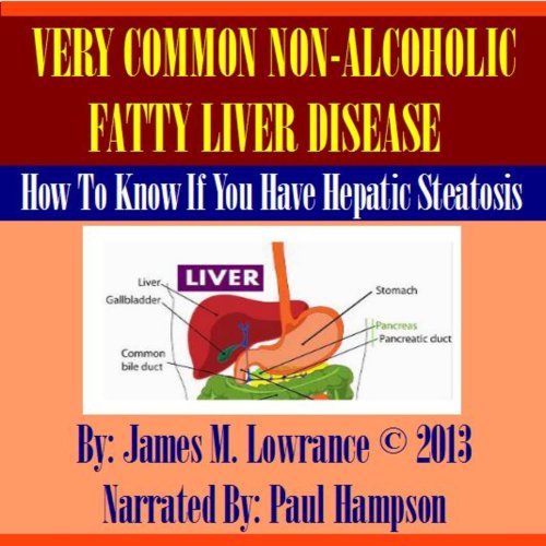 Cover of Very Common Non-Alcoholic Fatty Liver Disease
