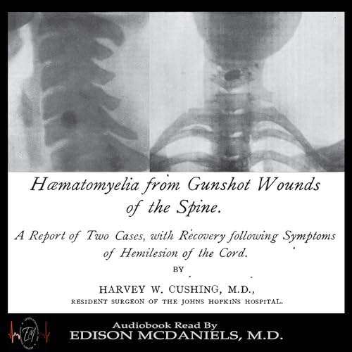 Cover of Haematomyelia from Gunshot Wounds of the Spine