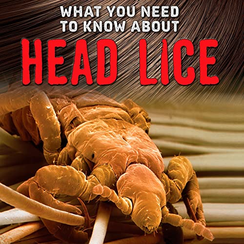 Cover of What You Need to Know About Head Lice