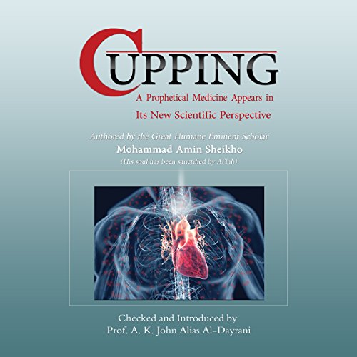 Cover of Cupping
