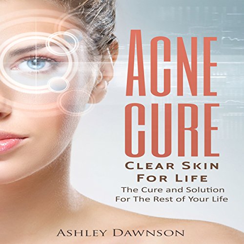Cover of Acne Cure Clear Skin for Life