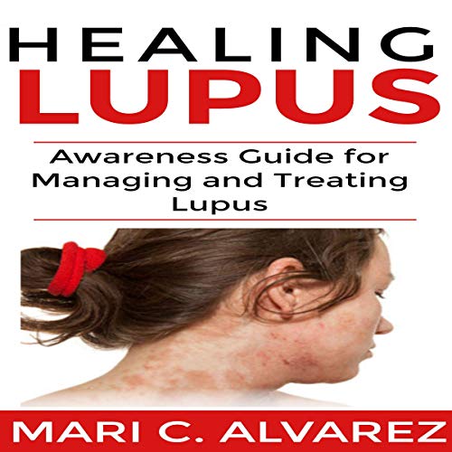 Cover of Healing Lupus