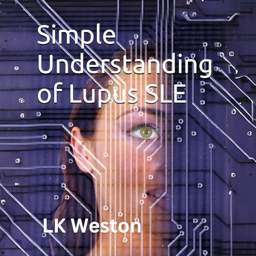 Cover of Simple Understanding of Lupus SLE