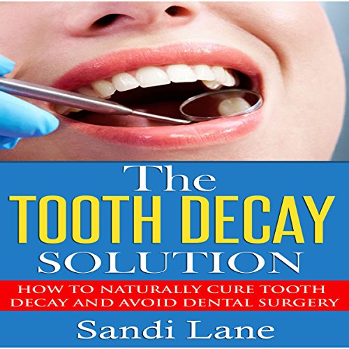 Cover of The Tooth Decay Solution