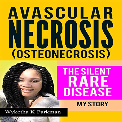 Cover of Avascular Necrosis (Osteonecrosis) the Silent Rare Disease: My Story