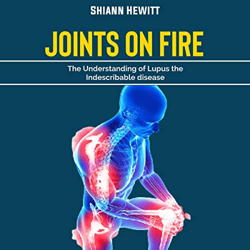 Cover of Joints on Fire