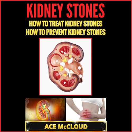 Cover of Kidney Stones