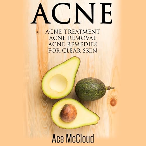Cover of Acne: Acne Treatment