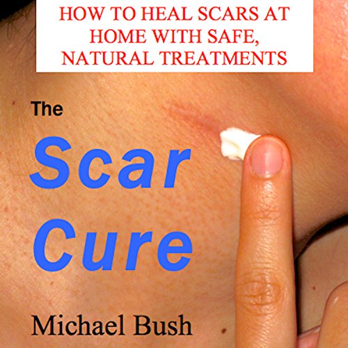Cover of The Scar Cure